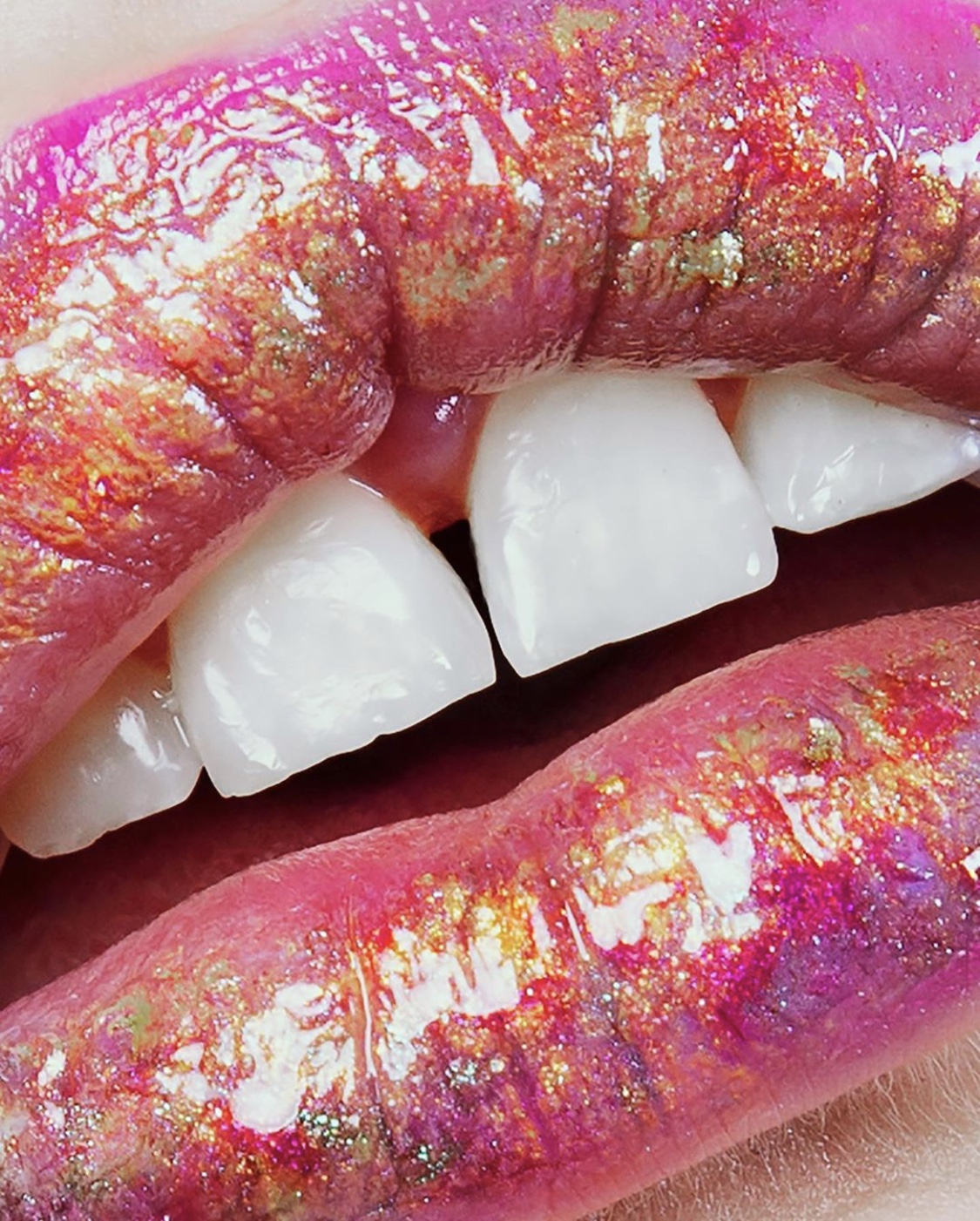 Lippen